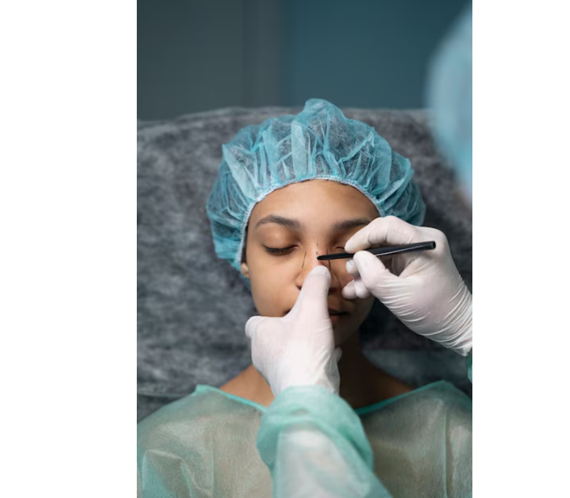 non surgical rhinoplasty london
